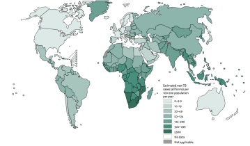 TB is a major public health challenge in developing countries